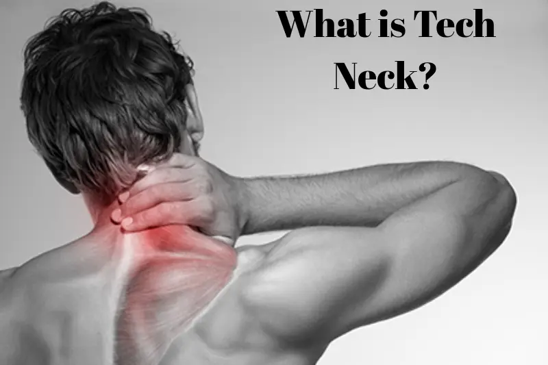 what is tech neck